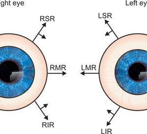 Motility Made Easy